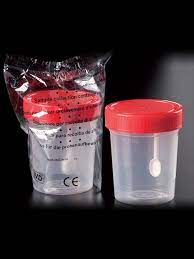 RECOLECTOR DE MUESTRA HECES GRANDE