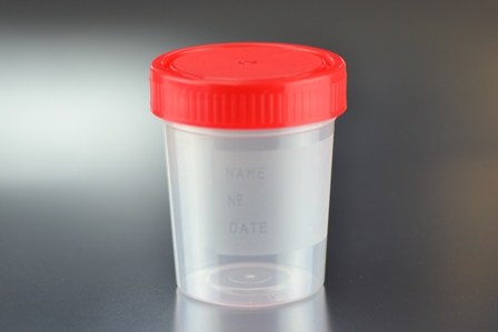 RECOLECTOR DE MUESTRA ORINA PEQUEÑA